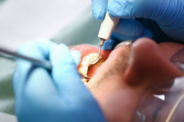 Best Teeth Whitening  in Moscow, PA
